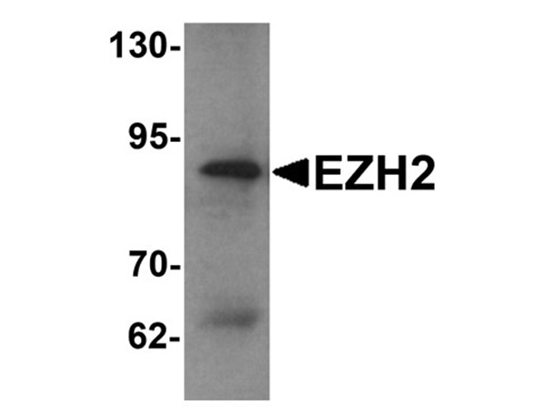 Western blot analysis of EZH2