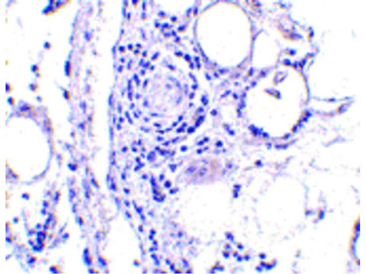 Immunohistochemistry of FABP7 Antibody