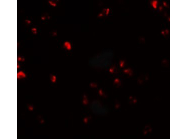 Immunofluorescence of FAM193B