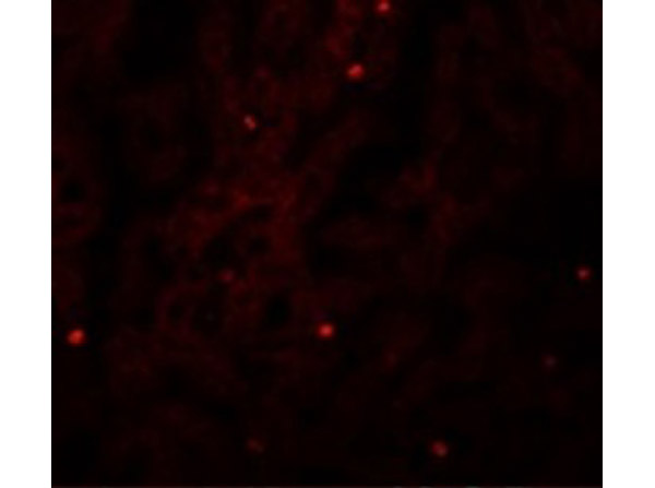 Immunofluorescence of FAM59A