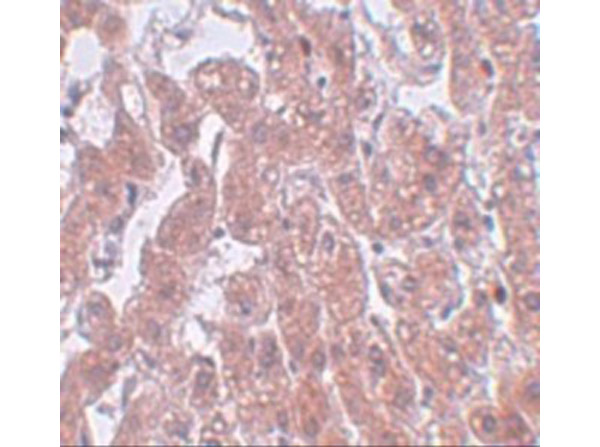 Immunohistochemistry of FAM59A