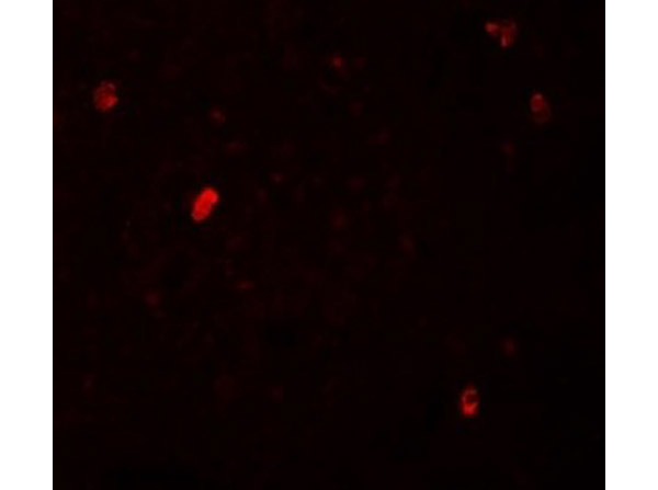 Immunofluorescence of FBXL16