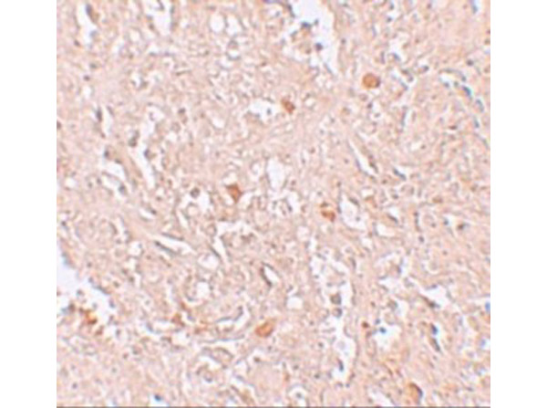 Immunohistochemistry of FBXL16