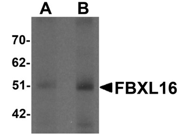 Western blot analysis of FBXL16