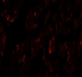 Immunofluorescence of FCHO2