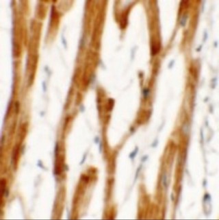 Immunohistochemistry of FCHO2