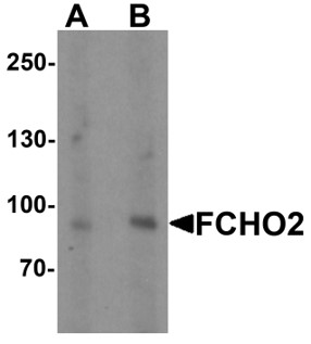 Western blot analysis of FCHO2