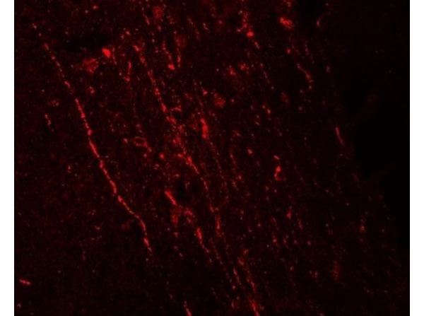 Immunofluorescence of FGFR3