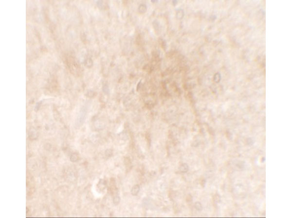 Immunohistochemistry of FGFR3