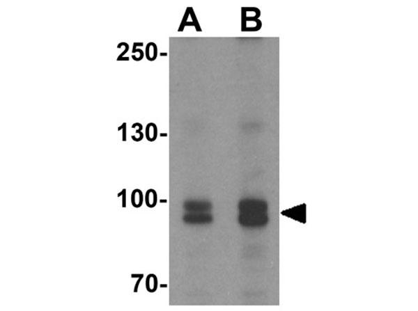 Western blot of FGFR3