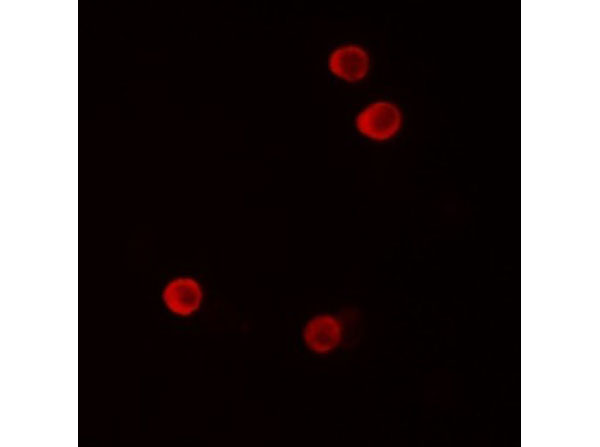 Immunofluorescence of FHIT