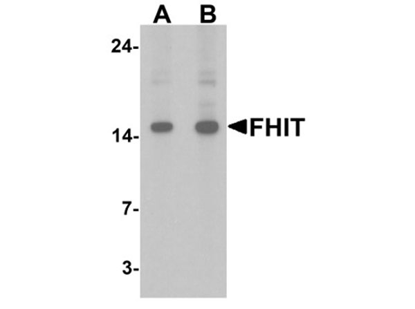 Western blot of FHIT