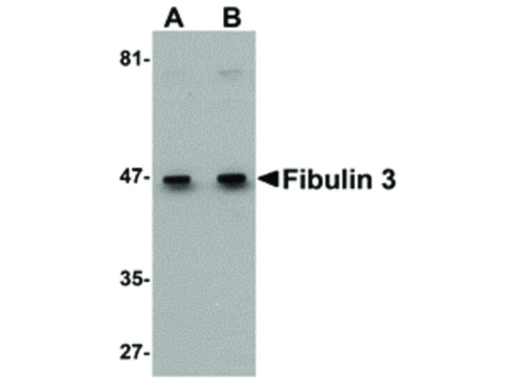 Western Blot of Fibulin 3 Antibody