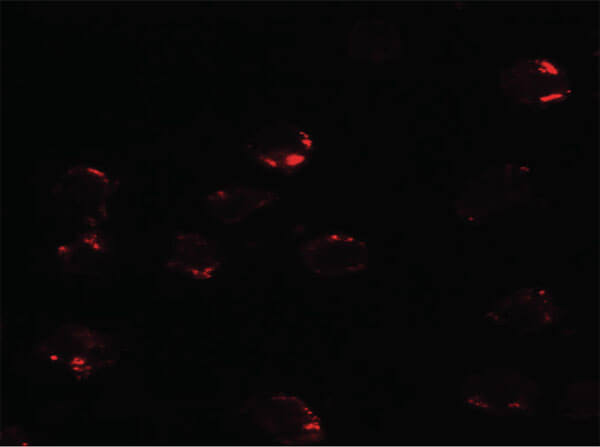 Immunofluorescence of FKBP12 Antibody