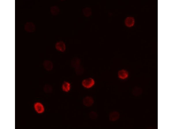 Immunofluorescence of FLI1