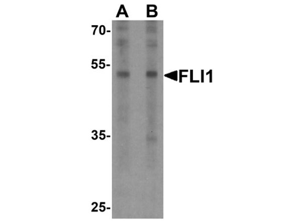 Western blot of FLI1
