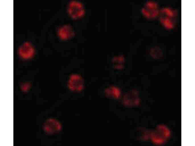 Immunofluorescence of FLIP Antibody
