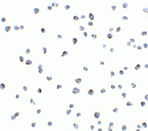 Immunocytochemistry of FLIP