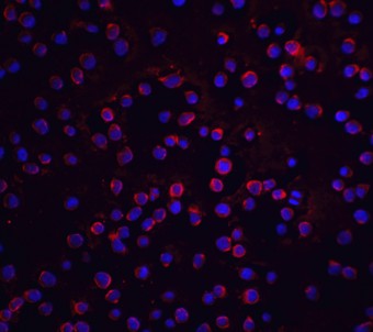 Immunofluorescence of FLIP