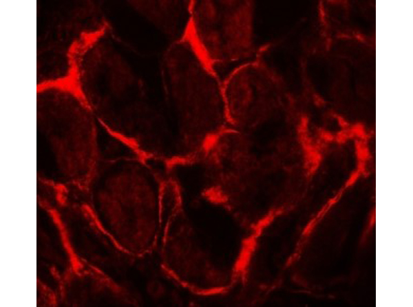 Immunofluorescence of FLT3