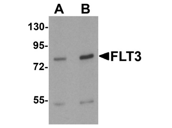 Western blot analysis of FLT3