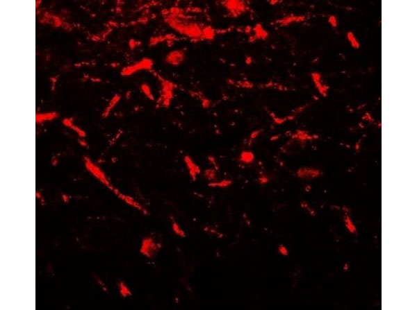 Immunofluorescence of FMR1