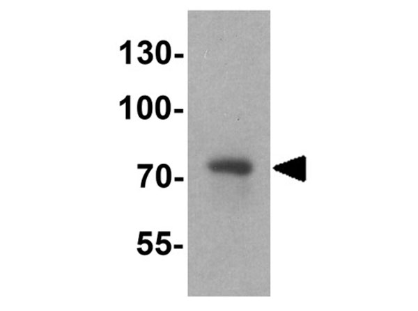 Western blot of FMR1