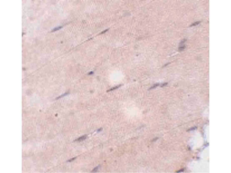 Immunohistochemistry of FNIP2 Antibody