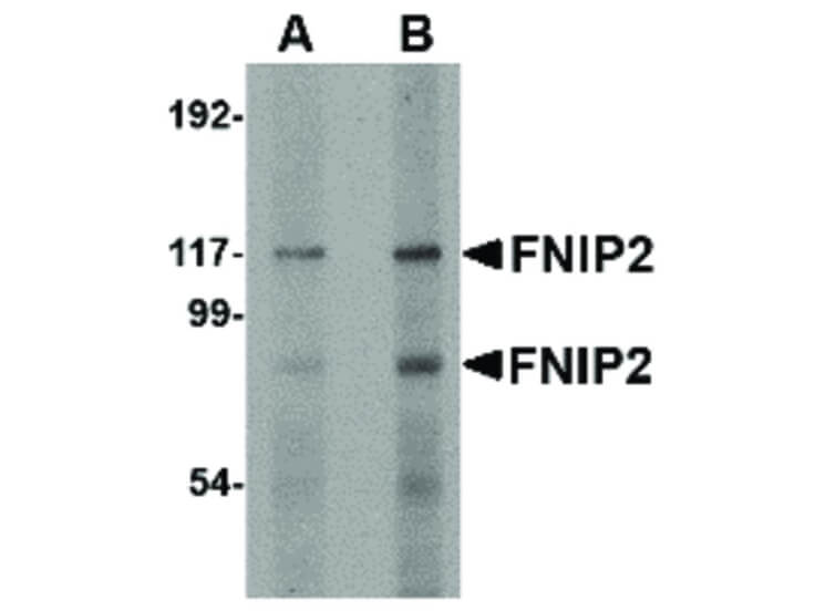 Western Blot of FNIP2 Antibody
