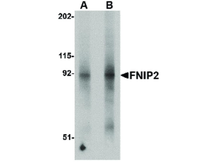 Western Blot of FNIP2 Antibody