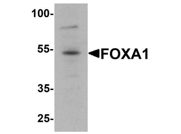 Western blot analysis of FOXA1