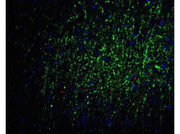 Immunofluorescence of FOXA2