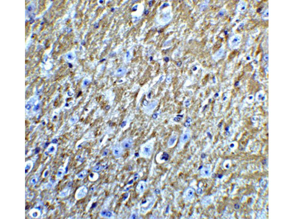 Immunohistochemistry of FOXA2