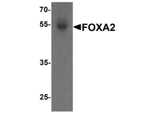 Western blot analysis of FOXA2