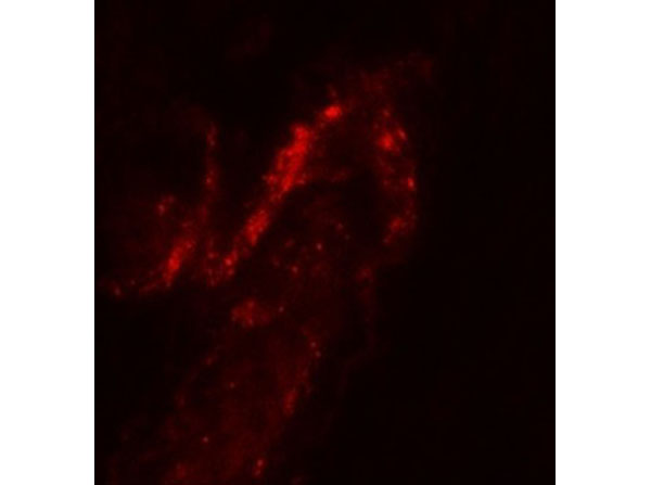 Immunofluorescence of FOXA2