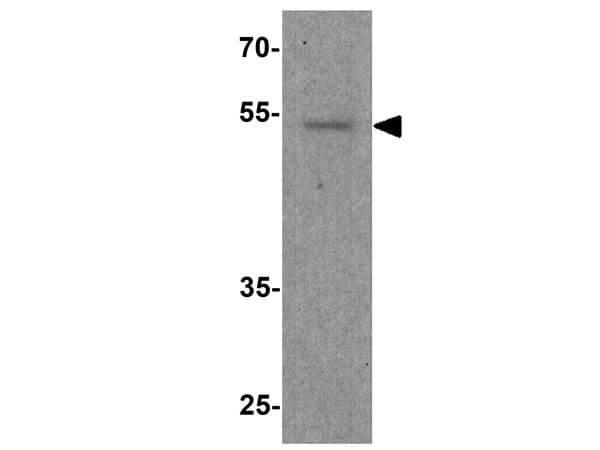 Western blot results of Anti-FOXG1 Antibody