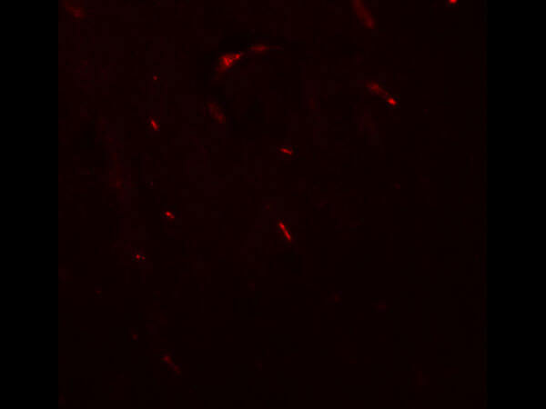 Immunofluorescence of Anti-FOXG1 Antibody