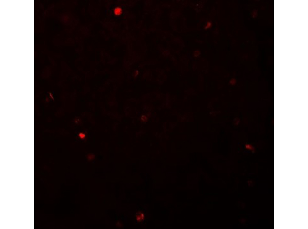Immunofluorescence of FOXH1