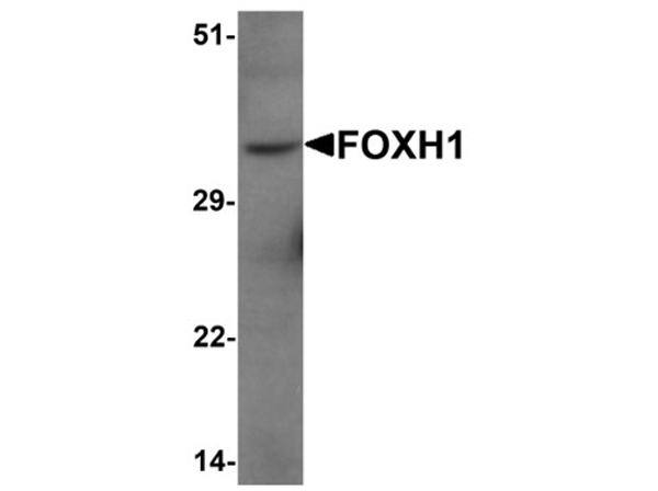 Western blot analysis of FOXH1