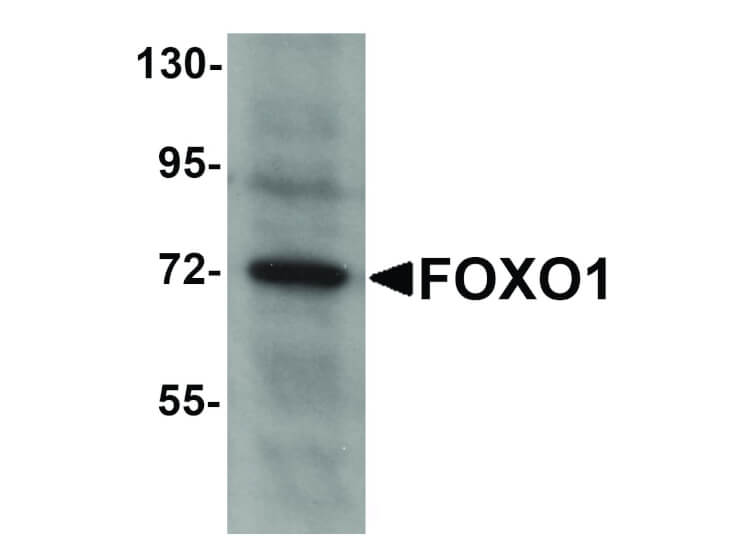 Western Blot of FOXO1 Antibody