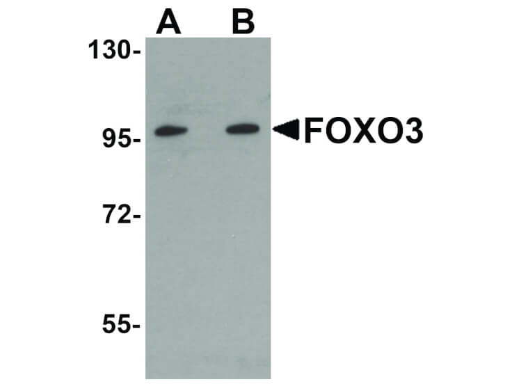 Western Blot of FOXO3 Antibody