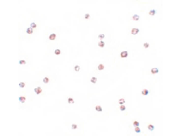 Immunocytochemistry of FOXO3 Antibody