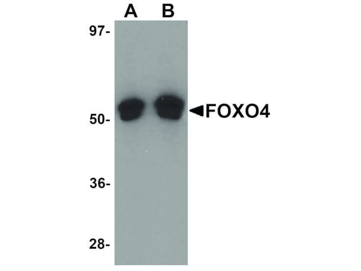 Western Blot of FOXO4 Antibody