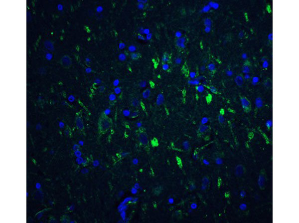 Immunofluorescence of FOXP3