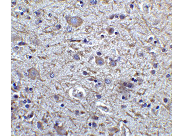Immunohistochemistry of FOXP3