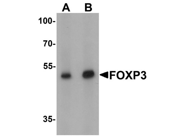Western blot analysis of FOXP3