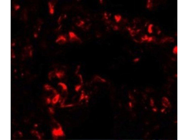 Immunofluorescence of FOXRED2