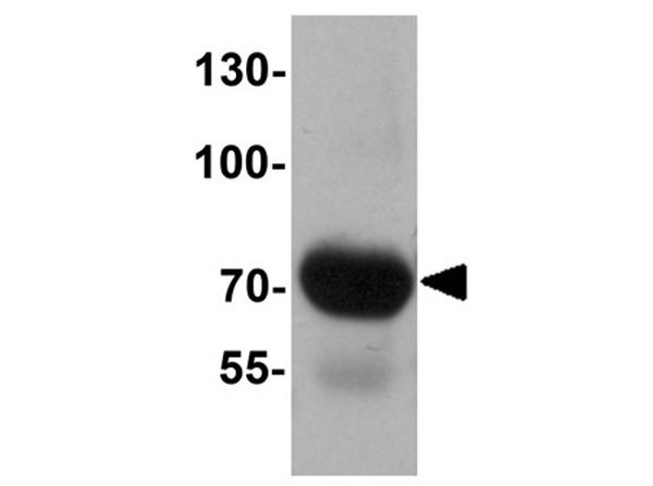 Western blot analysis of FOXRED2