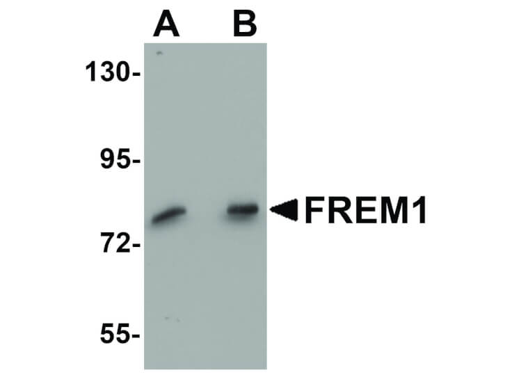Western Blot of FREM1 Antibody