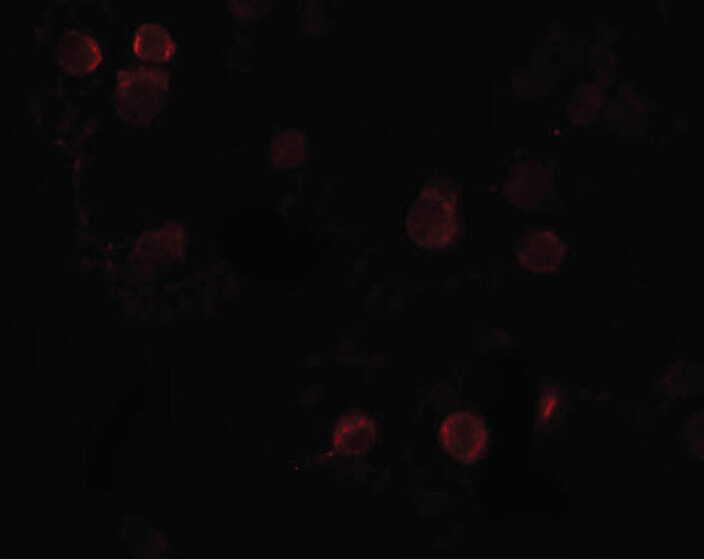 Immunofluorescence of FREM1 Antibody